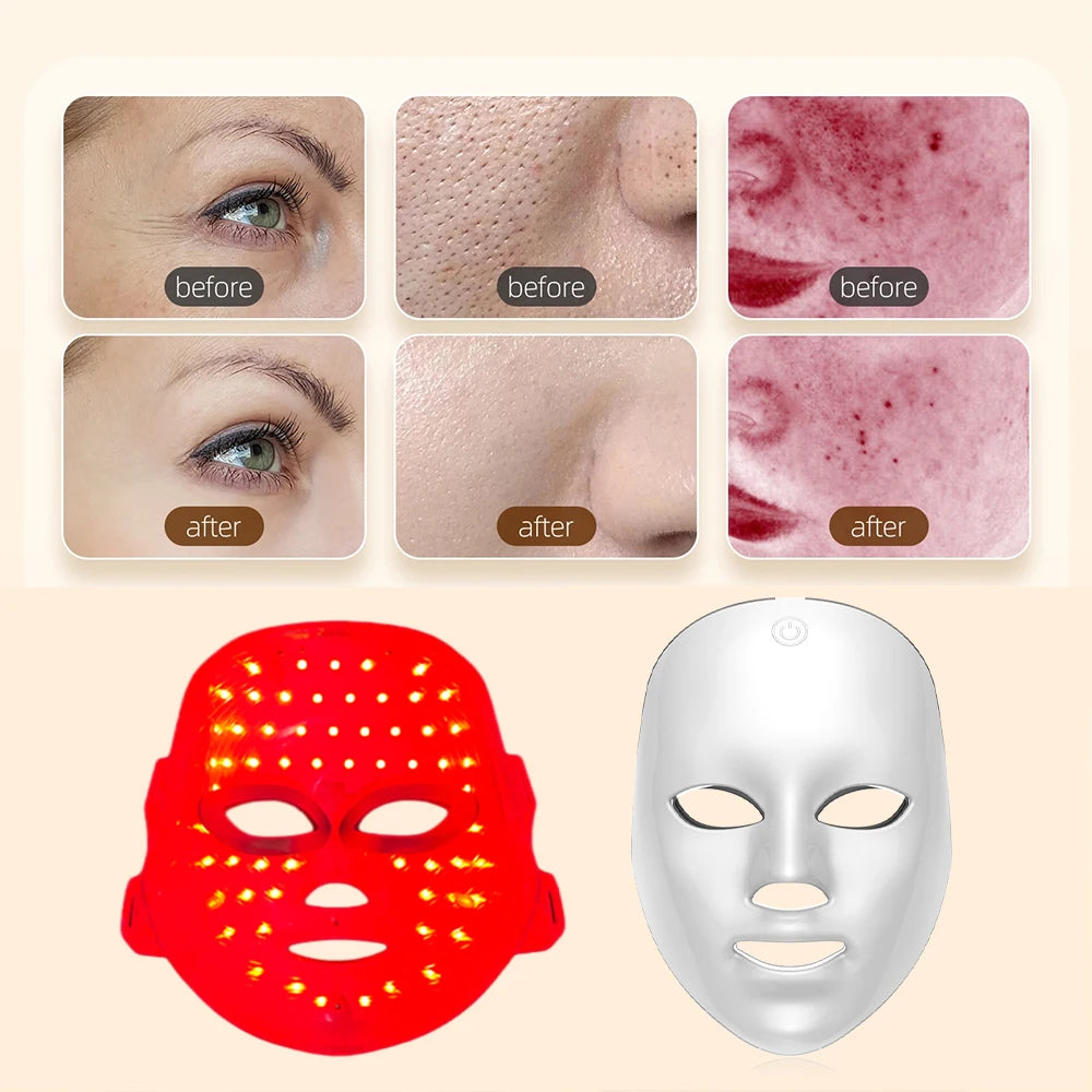 Máscara Facial de LED com 7 Cores Recarregável – Acessório de Beleza